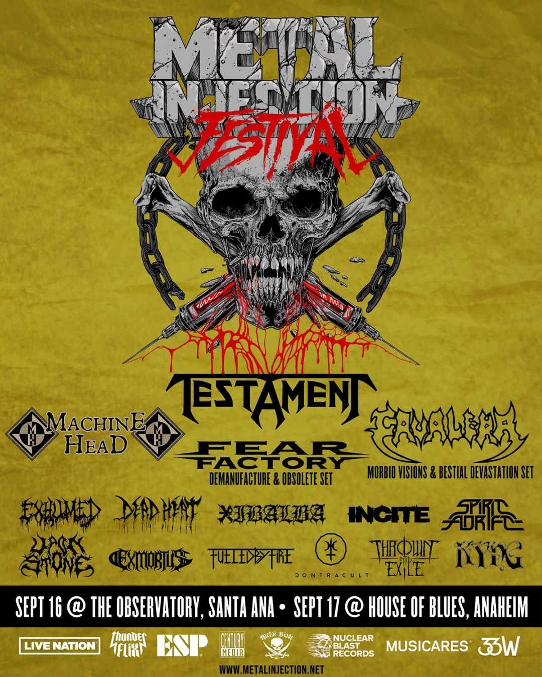 metal injection tours
